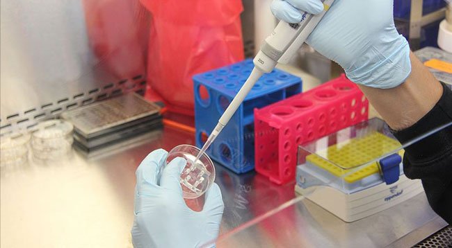Kovid-19 Tanısında En Güvenilir Sonucu PCR Testi Veriyor